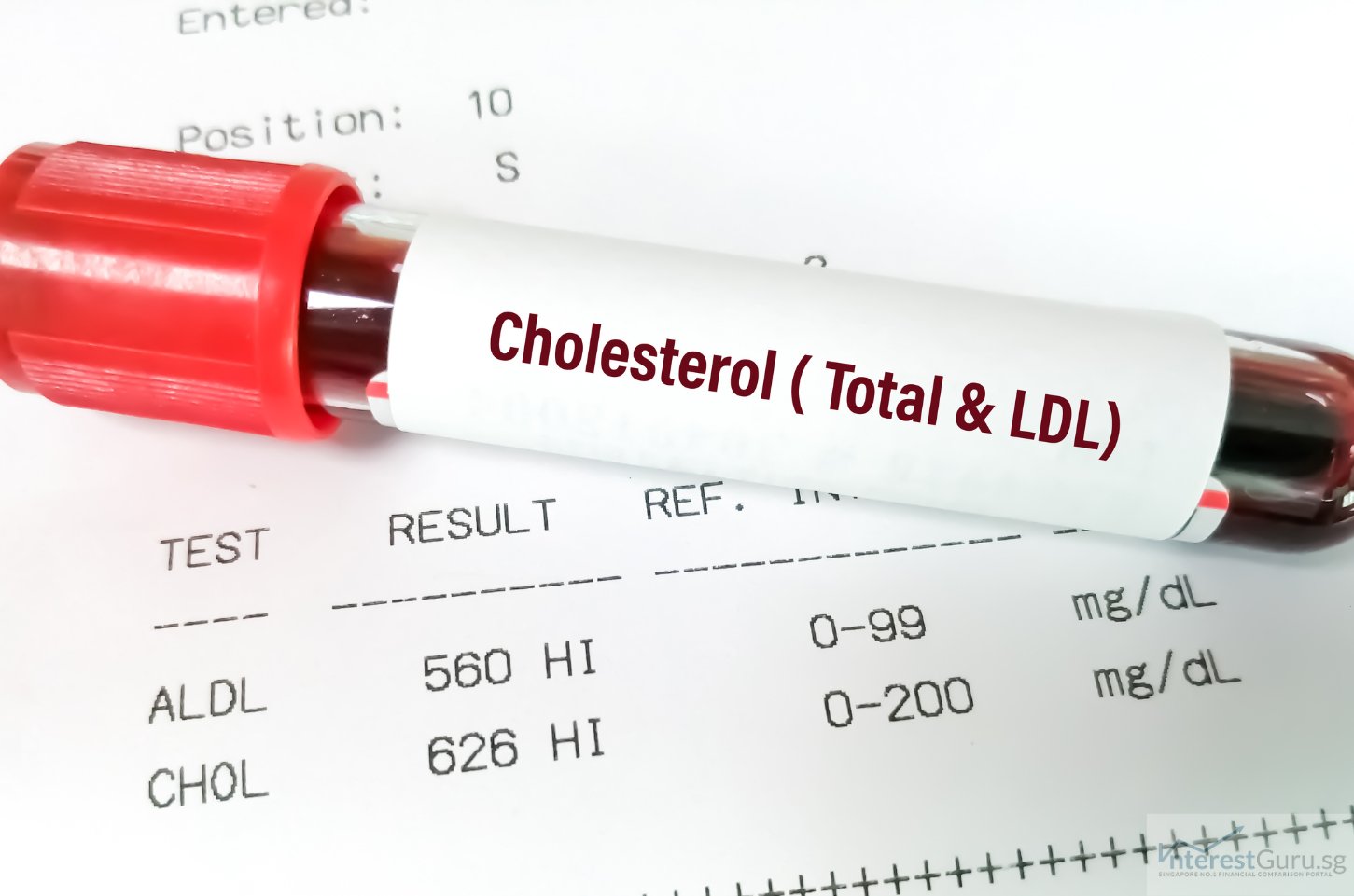 Blood pressure and cholesterol test results showing early detection